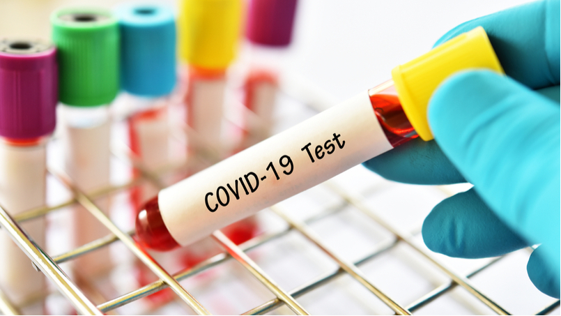Оперативна інформація про поширення коронавірусної інфекції COVID-19